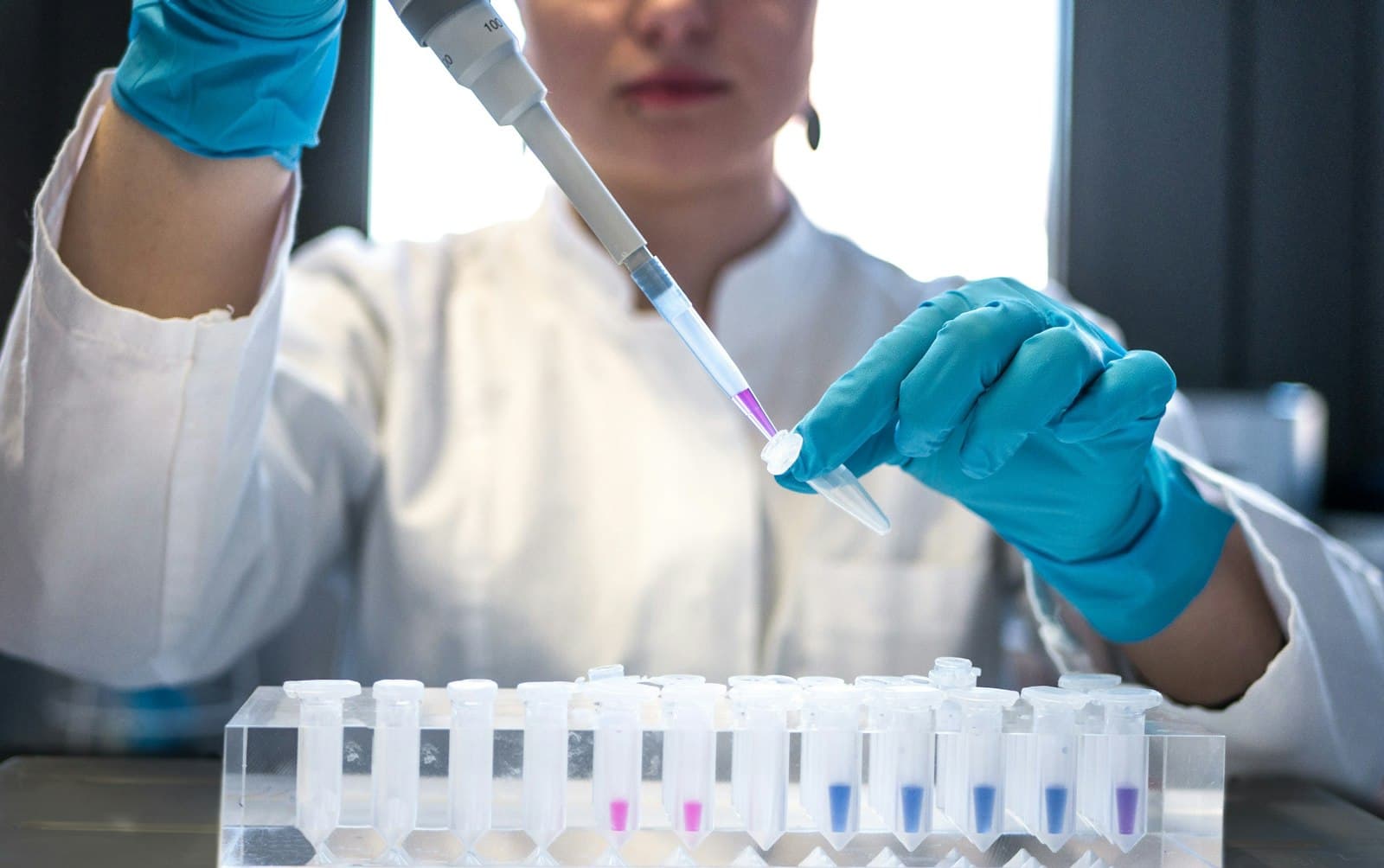 A lab technician using a pipette with test tubes, representing Max Labs's diagnostic testing